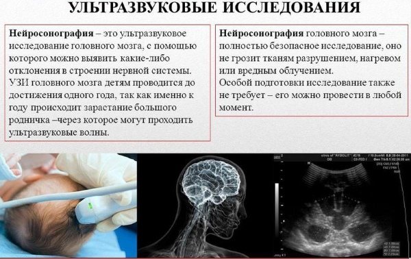 Объем головы у детей: формулы, таблица по возрасту, по месяцам до года у новорожденного ребенка, в 2, 3, 4, 5 лет. Как измерить, какой должен быть
