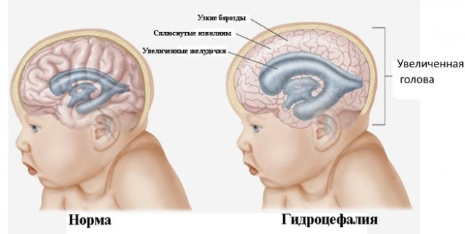 Объем головы у детей: формулы, таблица по возрасту, по месяцам до года у новорожденного ребенка, в 2, 3, 4, 5 лет. Как измерить, какой должен быть