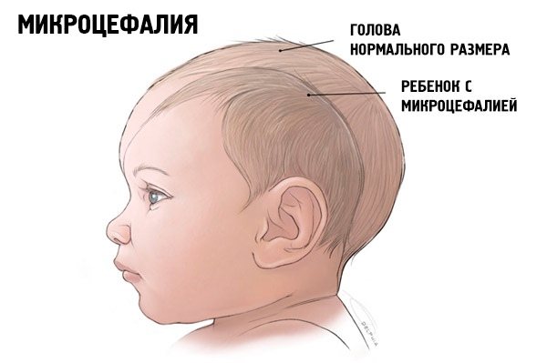 Объем головы у детей: формулы, таблица по возрасту, по месяцам до года у новорожденного ребенка, в 2, 3, 4, 5 лет. Как измерить, какой должен быть